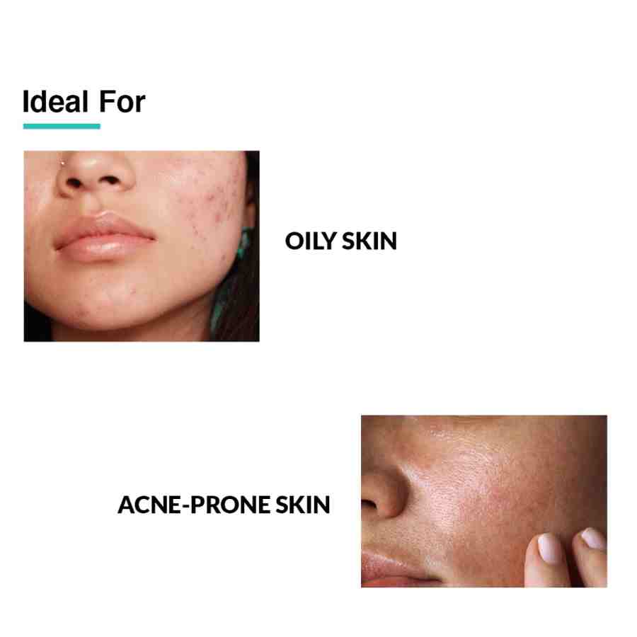 Fix Derma 2% Salicylic Acid Serum for Anti Acne & Spot Treatment with 5% Azelaic Acid & 4% Mandelic Acid, 30gm